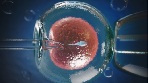 Fertilização in vitro, técnica de reprodução assistida - Imagem: Reprodução / Mater Prime