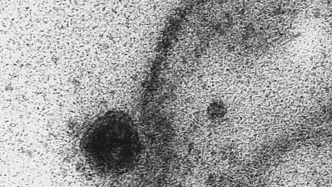USP: novo coronavírus infecta e se replica em glândulas salivares