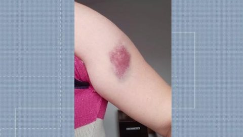 Técnica de enfermagem é agredida por homem em UPA de Guarulhos; veja vídeo