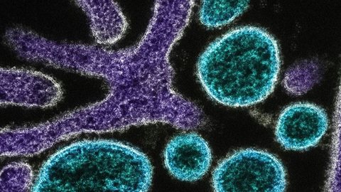 OMS mantém vigilância sobre o vírus Nipah, que já causou surtos na Índia, ressaltando a necessidade de monitoramento contínuo - Imagem: Reprodução/National Institute of Allergy and Infectious Diseases/Unsplash