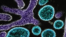 OMS mantém vigilância sobre o vírus Nipah, que já causou surtos na Índia, ressaltando a necessidade de monitoramento contínuo - Imagem: Reprodução/National Institute of Allergy and Infectious Diseases/Unsplash