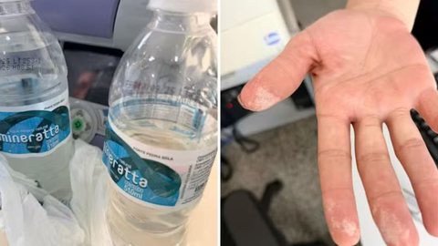 A investigação busca identificar o agente contaminante que causou queimaduras em um homem e sintomas em outras pessoas - Imagem: Reprodução / Polícia Civil de Garça
