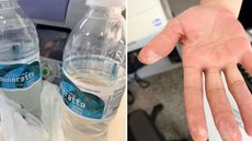 A investigação busca identificar o agente contaminante que causou queimaduras em um homem e sintomas em outras pessoas - Imagem: Reprodução / Polícia Civil de Garça