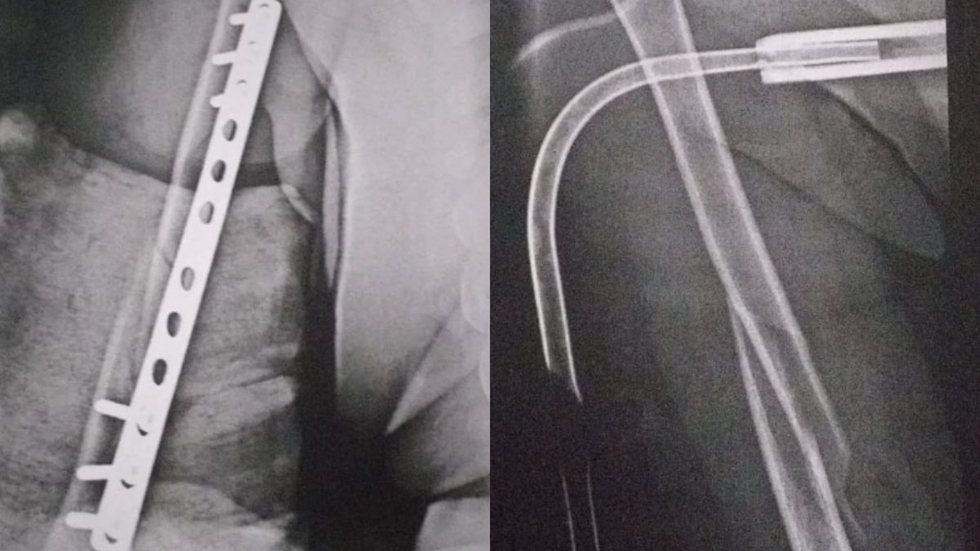 O estudante tem 15 anos e foi levado ao hospital. O professor é policial e foi afastado das suas funções - Imagem: Reprodução/Instagram @moabbrasil (Movimento do Orgulho Autista)