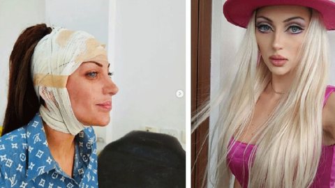A morte de Bárbara Jankavski Marquez, a 'Barbie Humana', levanta questões sobre a versão apresentada e os indícios de violência encontrados - Imagem: Reprodução/G1