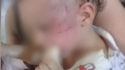 Pai é acusado de agredir o filho de 1 ano em Goiânia - Foto: Reprodução / G1