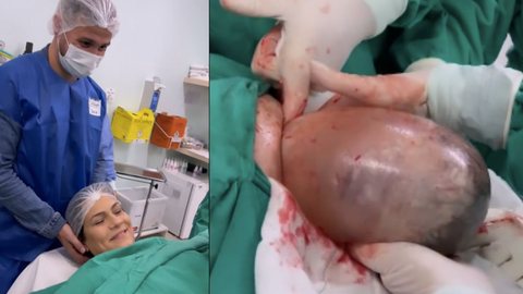 Bebê nasce 'empelicado' e pai faz surpresa a mãe após parto em SC - imagem: reprodução Instagram @brunacostafotografias