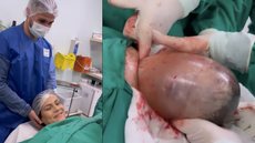 Bebê nasce 'empelicado' e pai faz surpresa a mãe após parto em SC - imagem: reprodução Instagram @brunacostafotografias