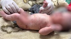 Menina recém-nascida foi achada dentro de saco de lixo - Imagem: divulgação/Polícia Militar