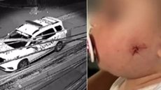 Bebê de 1 ano é baleada por PM em São Paulo - Imagem: Reprodução/TV Globo