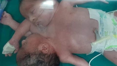As crianças nasceram em Mansoura, no Egito - Imagem: reprodução/Newsflash