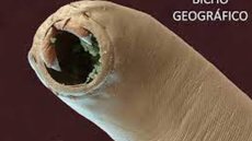 Bicho geográfico: parasita que anda embaixo da pele é comum e pode ser pego na praia; entenda - Imagem: reprodução Facebook Laboratório Citologus