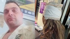 A Guarda Civil Municipal informou que a mulher ficou gravemente ferida após ser atacada por seu marido durante uma discussão. - Imagem: Reprodução | @metropoles.sp