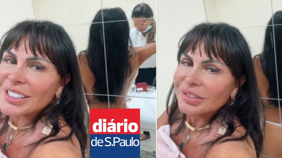 Bumbum na nuca! Aos 65 anos, Gretchen comemora novo procedimento estético - Imagem: Reprodução/ Instagram