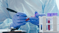 Novo exame de sangue desenvolvido por cientistas brasileiros pode ajudar na detecção precoce do câncer de mama com alta precisão - Imagem: Reprodução