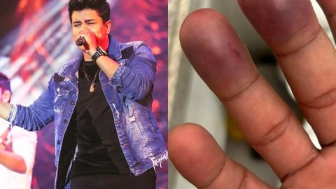 VÍDEO - cantor sertanejo fica ferido após cair do palco durante show - Imagem: reprodução redes sociais