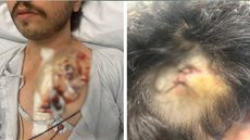 Médico (à esquerda) sofreu corte grave no pescoço e perfuração no pulmão após ataque com faca; advogado (à direita) teve ferimento na cabeça - Imagem: Divulgação