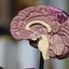 Cientistas buscam entender os mecanismos de proteção do cérebro humano contra o Alzheimer - Imagem: Reprodução/Robina Weermeijer/Unplash