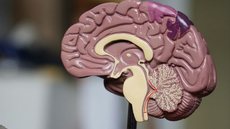 Cientistas buscam entender os mecanismos de proteção do cérebro humano contra o Alzheimer - Imagem: Reprodução/Robina Weermeijer/Unplash