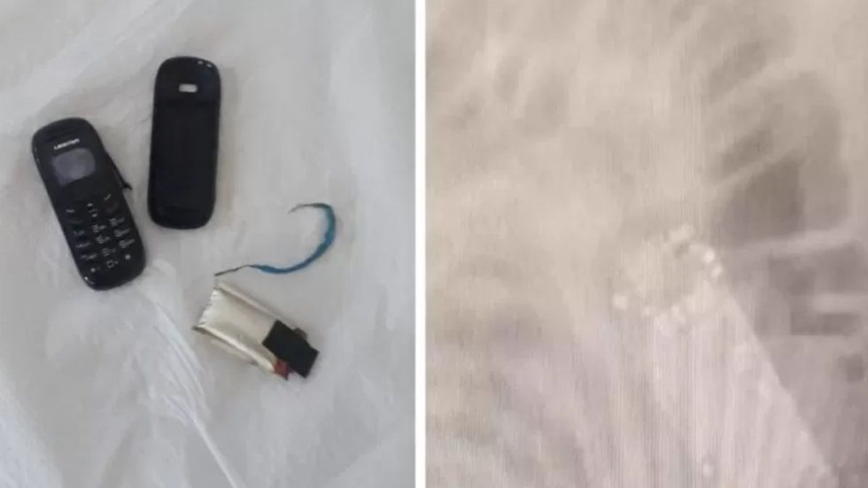 Detento tenta esconder aparelho celular de forma desesperadora e surpreende policiais - Imagem: divulgação