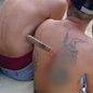 Chocante: Homem fica com faca cravada nas costas após discussão - Imagem: Reprodução/UOL