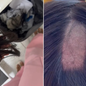 Ana Karolina denunciou nas redes sociais que teve parte do cabelo raspada durante coleta para exame toxicológico obrigatório para emissão da CNH na Paraíba - Imagem: Reprodução
