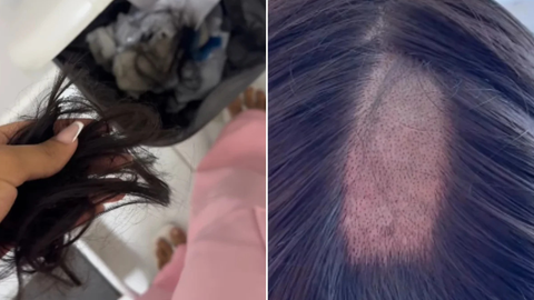 Ana Karolina denunciou nas redes sociais que teve parte do cabelo raspada durante coleta para exame toxicológico obrigatório para emissão da CNH na Paraíba - Imagem: Reprodução