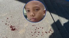Garoto de 7 anos mata amigo da pior maneira possível - Imagem: Divulgação / Redes Sociais | Reprodução / Dreamstime