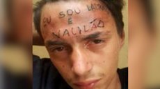 Criminoso que teve testa tatuada com “eu sou ladrão e vacilão” é preso novamente em SP - Imagem: Reprodução / Redes Sociais