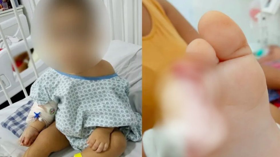 Bebê de 1 ano tem dedos decepados em creche de SP; veja o que aconteceu - Imagem: reprodução g1