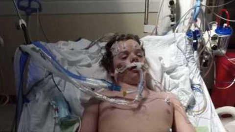 'Desafio Benadryl' causa primeira morte de adolescente por overdose de antialérgico - Imagem: Reprodução | Facebook