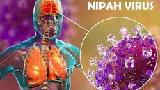 O vírus Nipah é considerado prioritário pela OMS devido à sua alta letalidade e potencial de transmissão entre humanos - Imagem: Reprodução/Redes Sociais