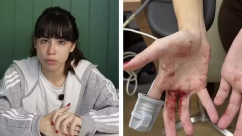 O crime ocorreu enquanto a atriz estava em um carro de aplicativo, resultando em ferimentos e críticas à segurança pública - Imagem: Reprodução/G1