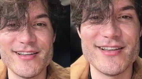 Eliezer desfaz harmonização facial e revela distorção de imagem; confira antes e depois - Imagem: Reprodução/ Instagram @Eliezer