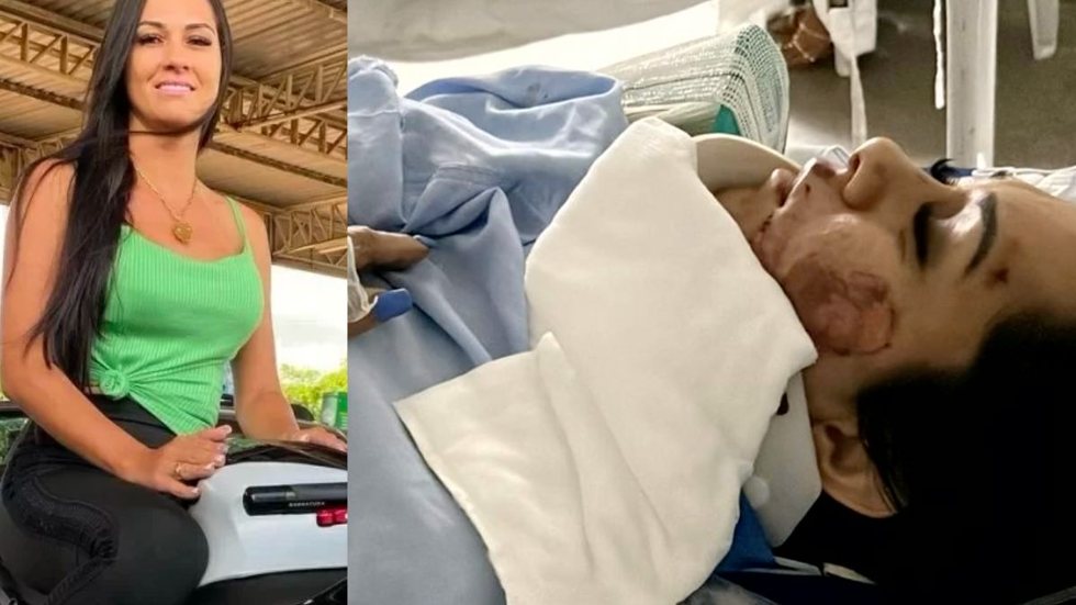 Enfermeira tenta salvar esposa que apanhava de marido e é atropelada por agressor - Imagem: reprodução Instagram / TV Anhanguera