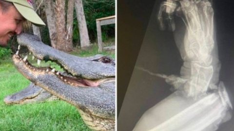 Raio-X mostra o estrago do ataque de jacaré no antebraço de especialista - Imagem: reprodução Facebook - Florida Gator Gardens