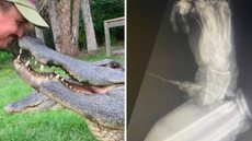 Raio-X mostra o estrago do ataque de jacaré no antebraço de especialista - Imagem: reprodução Facebook - Florida Gator Gardens