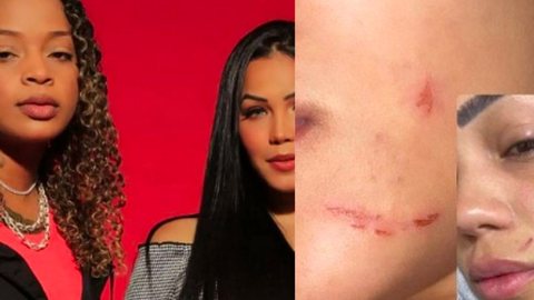 MC Dricka: ex da cantora expõe foto de hematomas e revela motivo das agressões - Imagem: reprodução Instagram