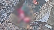 VÍDEO FORTE mostra feto que foi abandonado em esgoto - Imagem: reprodução Canva