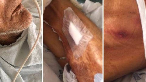 Enfermeira é acusada de espancar idoso com AVC em hospital de SP - Imagem: reprodução R7