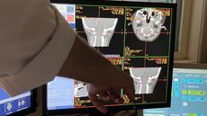 Brasil testa tratamento inédito para doença rara. - Imagem: Divulgação HCPA.
