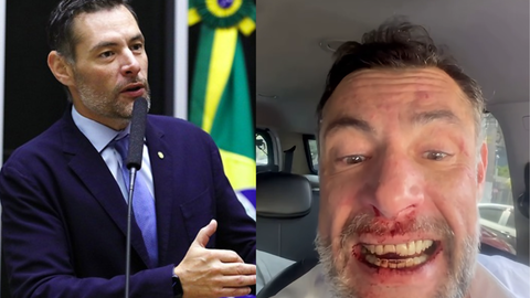 Deputado acusado de agressão diz que é vítima e caso explode no país - Imagem: Reprodução