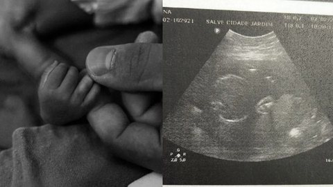 A mãe descobriu que o bebê não tinha cérebro no 7º mês de gestação - Imagem: reprodução/TV Globo
