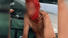 Idoso em situação de rua tendo cabelo e barba pintados em troca de doações gerou indignação nas redes. - Imagem: Reprodução