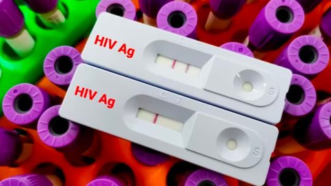 Teste HIV. - Imagem: Reprodução | Freepik