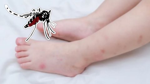 Dengue - Imagem: Reprodução | Freepik