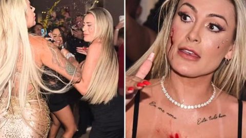 IMAGENS FORTES! Andressa Urach leva surra em briga e vai parar no hospital - Imagem: Reprodução/Instagram