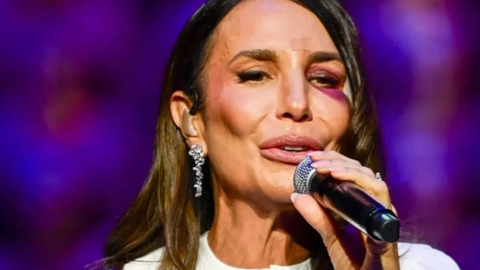 Ivete Sangalo aparece com olho roxo após desmaio e queda em casa - Imagem: Reprodução | Redes Sociais
