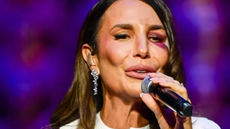 Ivete Sangalo aparece com olho roxo após desmaio e queda em casa - Imagem: Reprodução | Redes Sociais