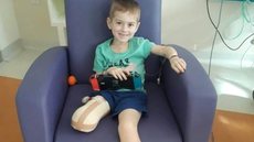Jake Bond demonstrou coragem após amputar perna por causa de doença - Imagem: reprodução/The Sun